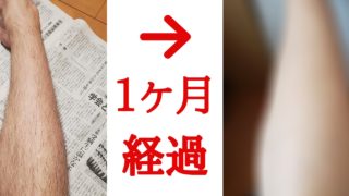 脱毛ラボホームエディションを1か月やったあとのビフォーアフター