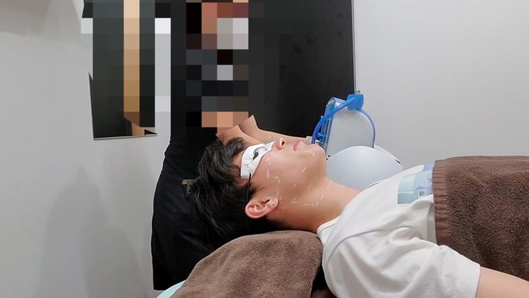 笑気麻酔